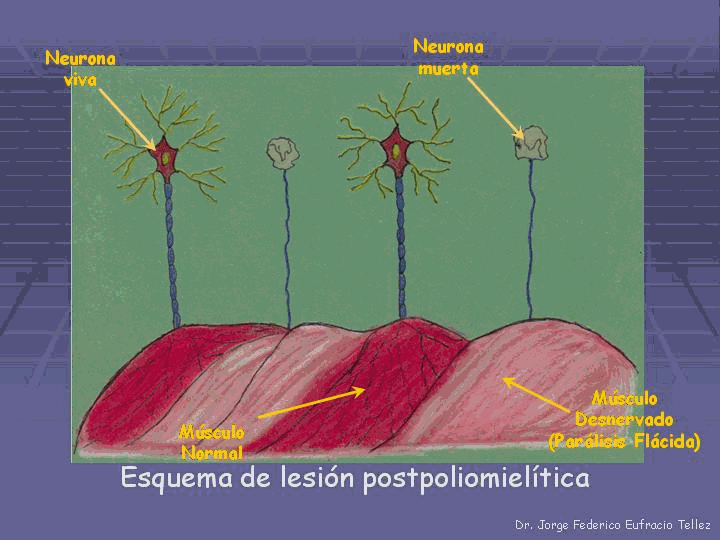 omcetpac