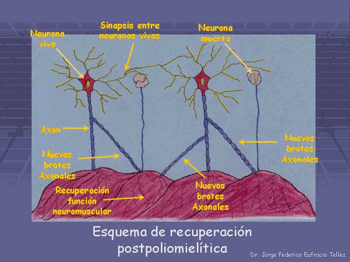 omcetpac