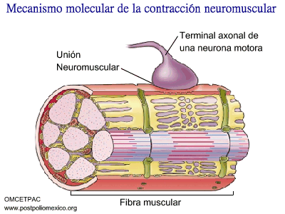 omcetpac