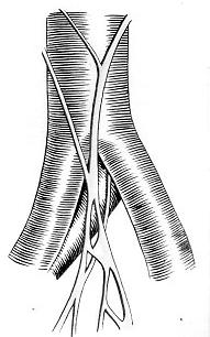 omcetpac