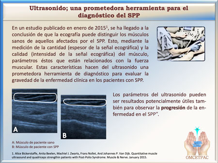 notas en imagenes OMCETPAC